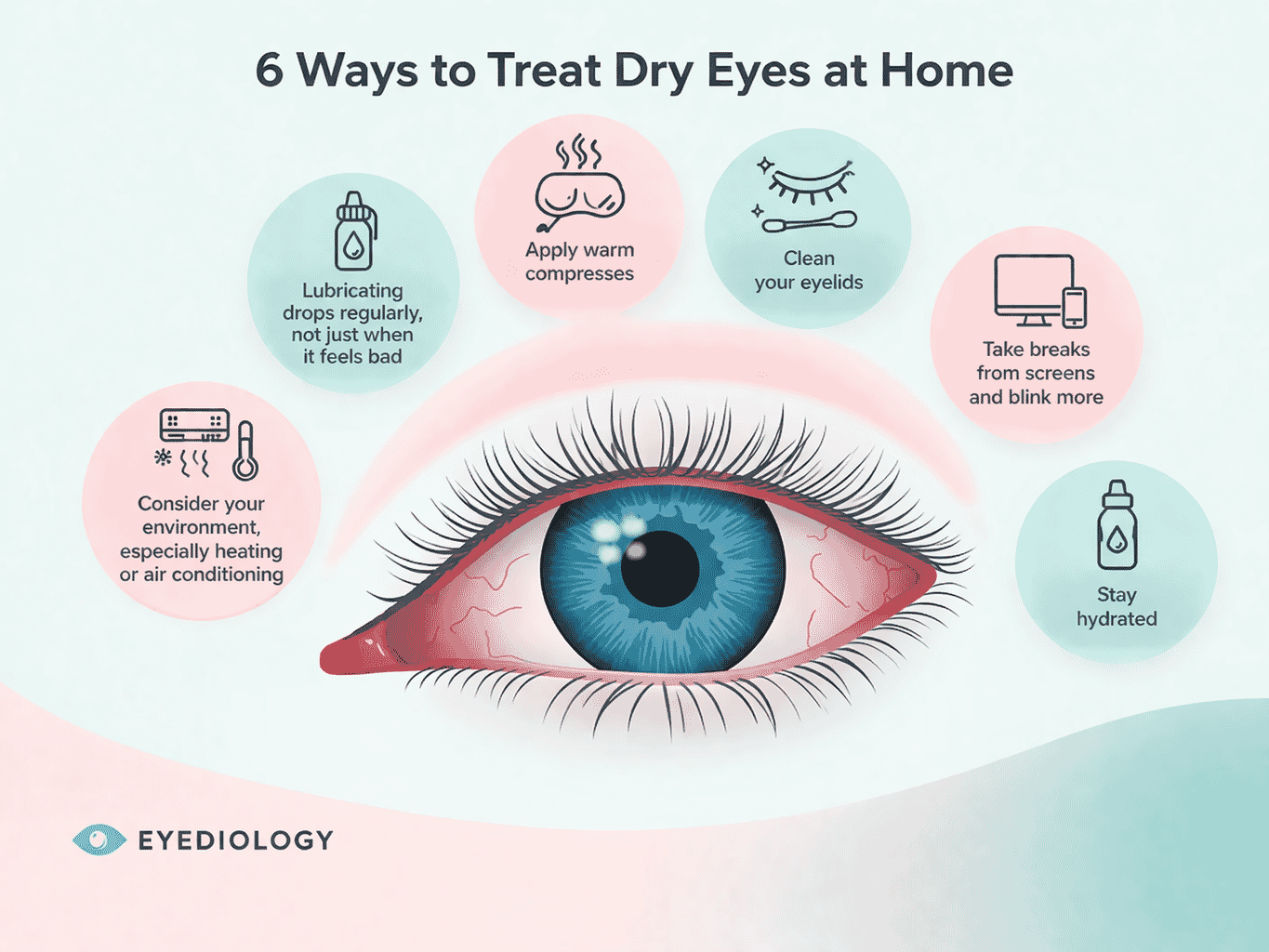Infographic showing six ways to treat dry eyes at home including lubricating drops, warm compresses, eyelid cleaning, screen breaks, hydration, and managing air conditioning.